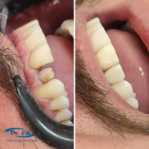 Dentistica-4.webp