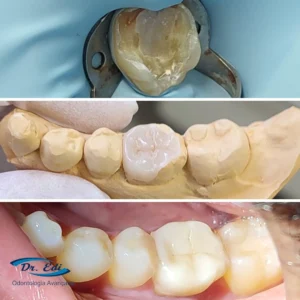 Dentistica-5.webp