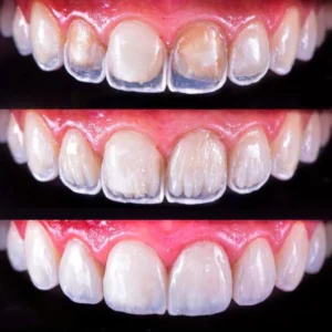 Facetas-3-1.webp
