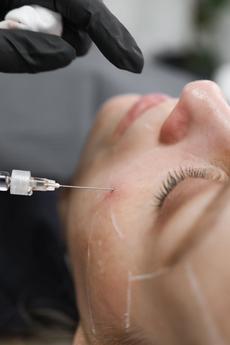 Bioestimuladores de Colágeno: O Segredo para Firmeza e Rejuvenescimento Natural