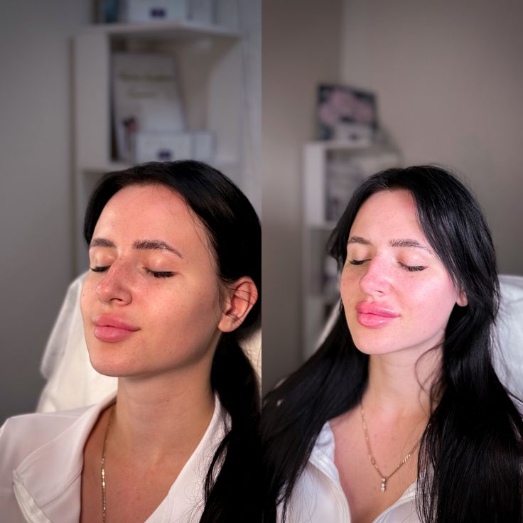 O que é Harmonização Facial e Corporal? Descubra como realçar sua beleza com equilíbrio e naturalidade