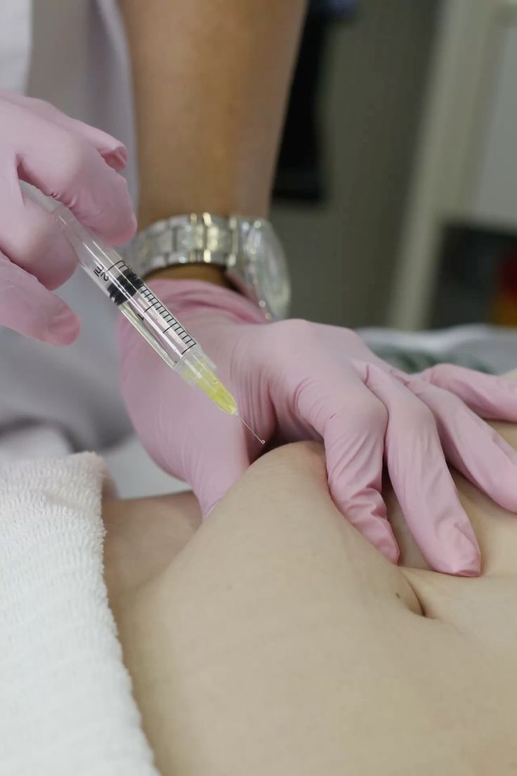 Lipo Enzimática: A Solução Para Reduzir Gordura Localizada Sem Cirurgia