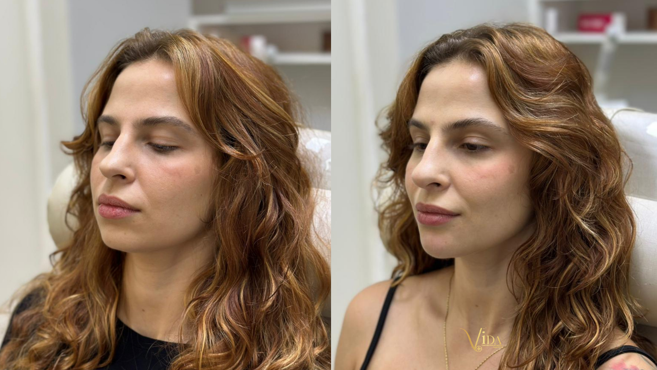 Seu queixo pode estar comprometendo todo o seu perfil… e você nem percebe!